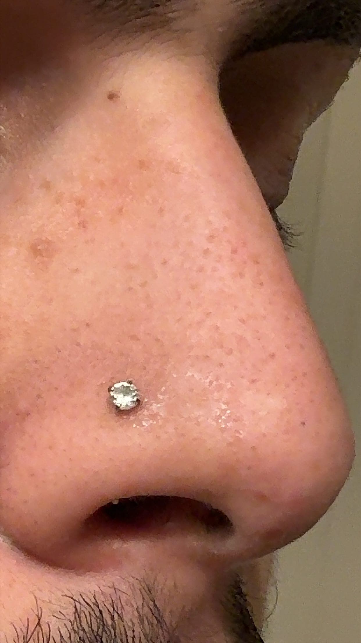 Real customer skin after using the Veloura pores & congestion routine — The Pore Reset Duo · after first use