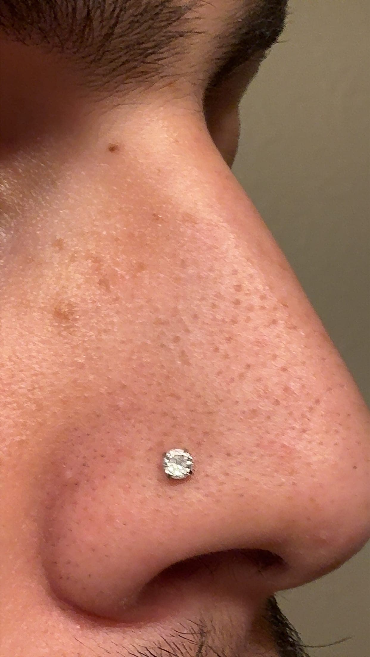 Real customer skin before using the Veloura pores & congestion routine — The Pore Reset Duo · after first use
