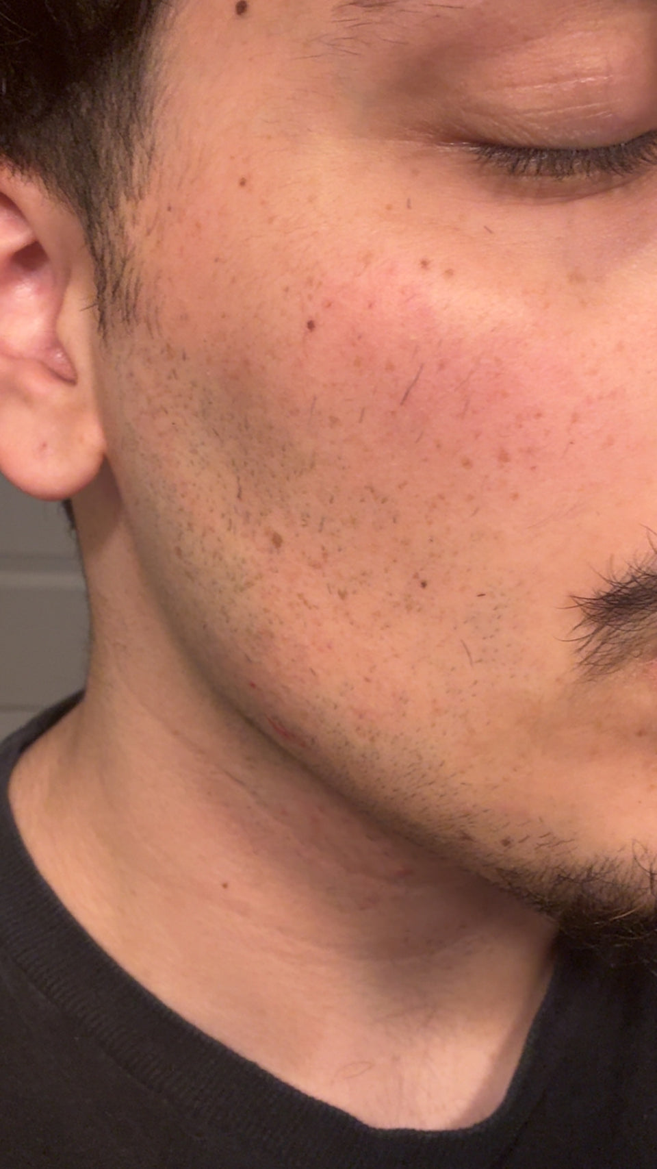 After